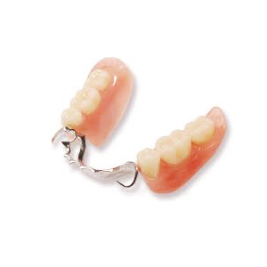 Cast Partial Denture (部分義歯)