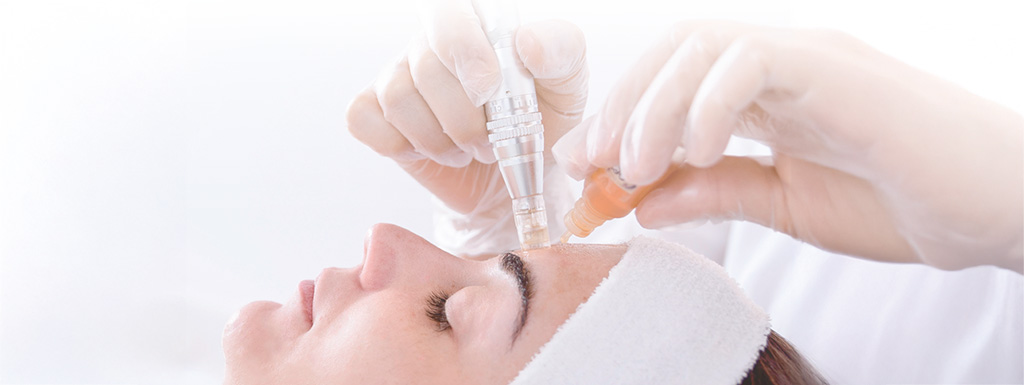 Microneedling with PRF